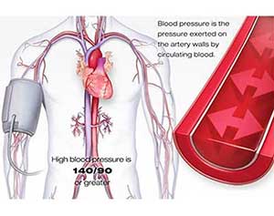 Hypertension/High Blood Pressure - Dr. VT Shah